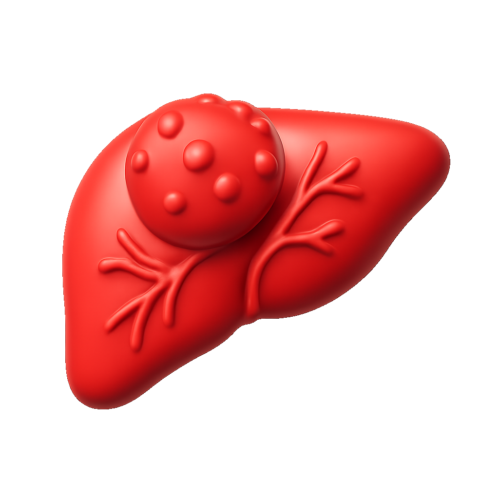 肿瘤 khối u