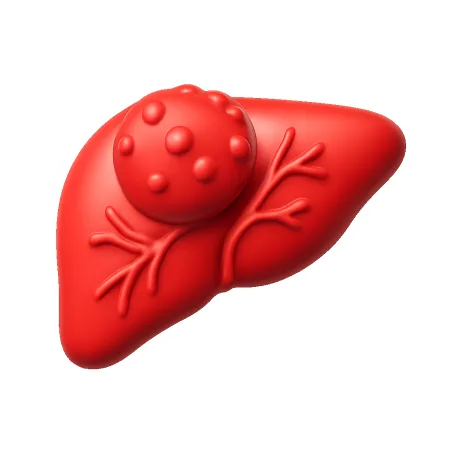 肿瘤 khối u